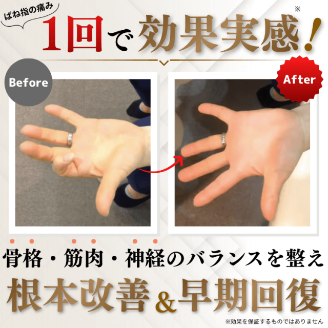 ばね指の痛み1回で効果実感！骨格・筋肉・神経のバランスを整え、根本改善&早期回復